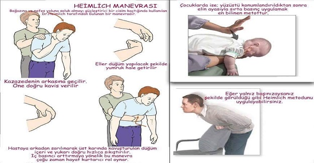 Bogazina Yabanci Bir Cisim Kacan Kisiye Nasil Yardim Edilir