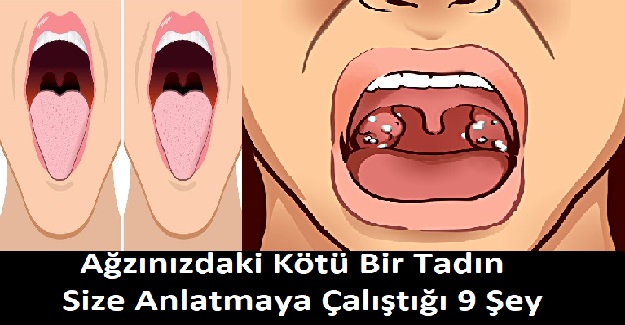 Ağzınızdaki Kötü Tadın Size Anlatmaya Çalıştığı 9 Sağlık Sorunu