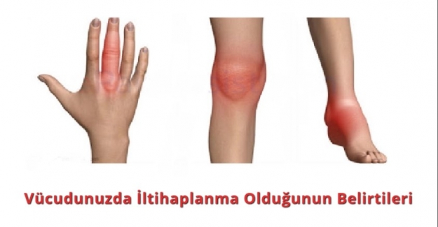Vücudunuzda İltihaplanma Olduğunun Belirtileri