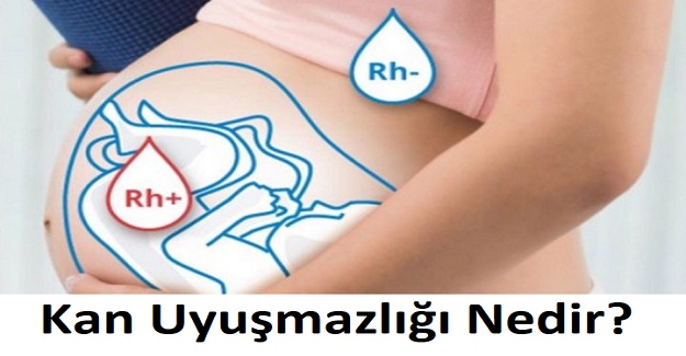 Kan Uyuşmazlığı Nedir?