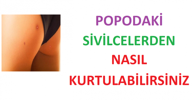 Popomdaki Sivilcelerden Kurtulmak İçin Ne Yapabilirim?