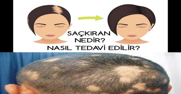 Saçkıran Nedir? Saçkıran Nasıl Anlaşılır?