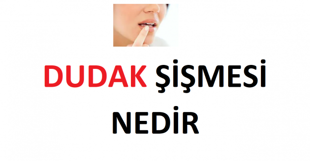 Dudak Şişmesi Sebebi Nedir, Nasıl Tedavi Edilir?