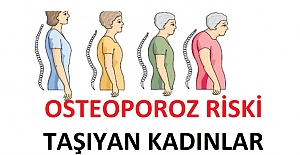 Osteoporoz Riski Taşıyan Kadınlar ve Osteoporoz Tedavisi