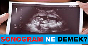 Sonogram Ne Demek?