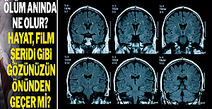 Ölürken Hayatımız Film Şeridi Gibi Geçiyor mu?
