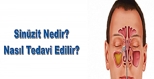 Sinüs Enfeksiyonu İçin Ne Yapılabilir?
